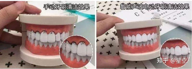 电动自行车行业现状_电动牙刷选购技巧_电动牙刷避雷指南